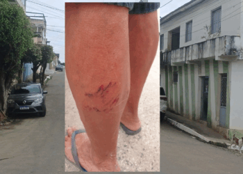 Cachorros da Avenida Maria Moreira voltam a atacar e são retirados do local