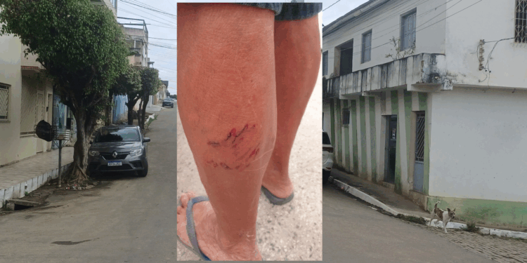 Cachorros da Avenida Maria Moreira voltam a atacar e são retirados do local