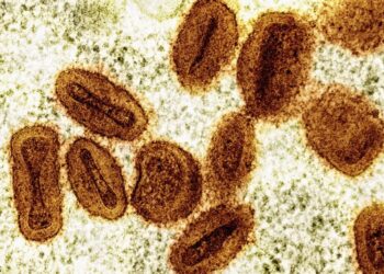 Bahia tem dois casos de Mpox confirmados em 2026