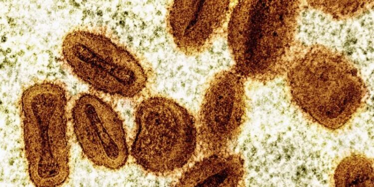 Bahia tem dois casos de Mpox confirmados em 2026